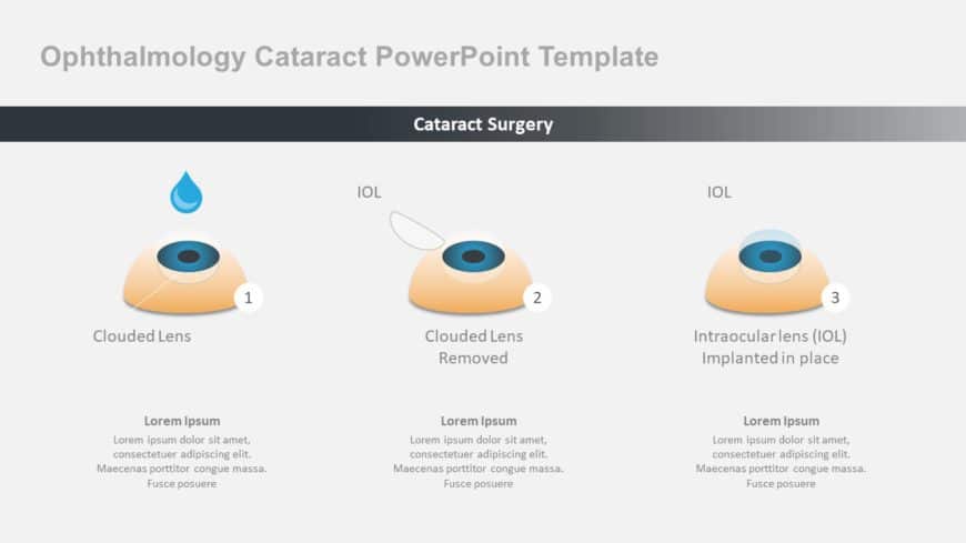 Ophthalmology Cataract PowerPoint Template