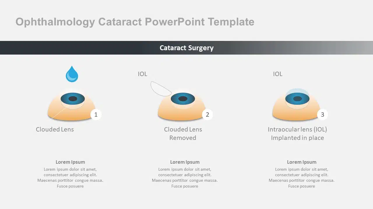 Ophthalmology Cataract PowerPoint Template & Google Slides Theme